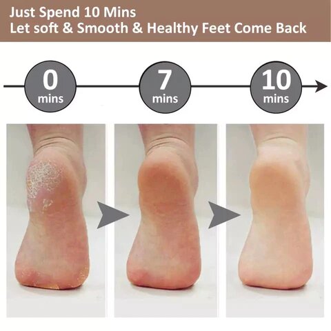 ELECTRIC PEDI CALLUS REMOVER