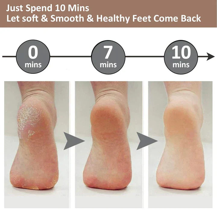 ELECTRIC PEDI CALLUS REMOVER